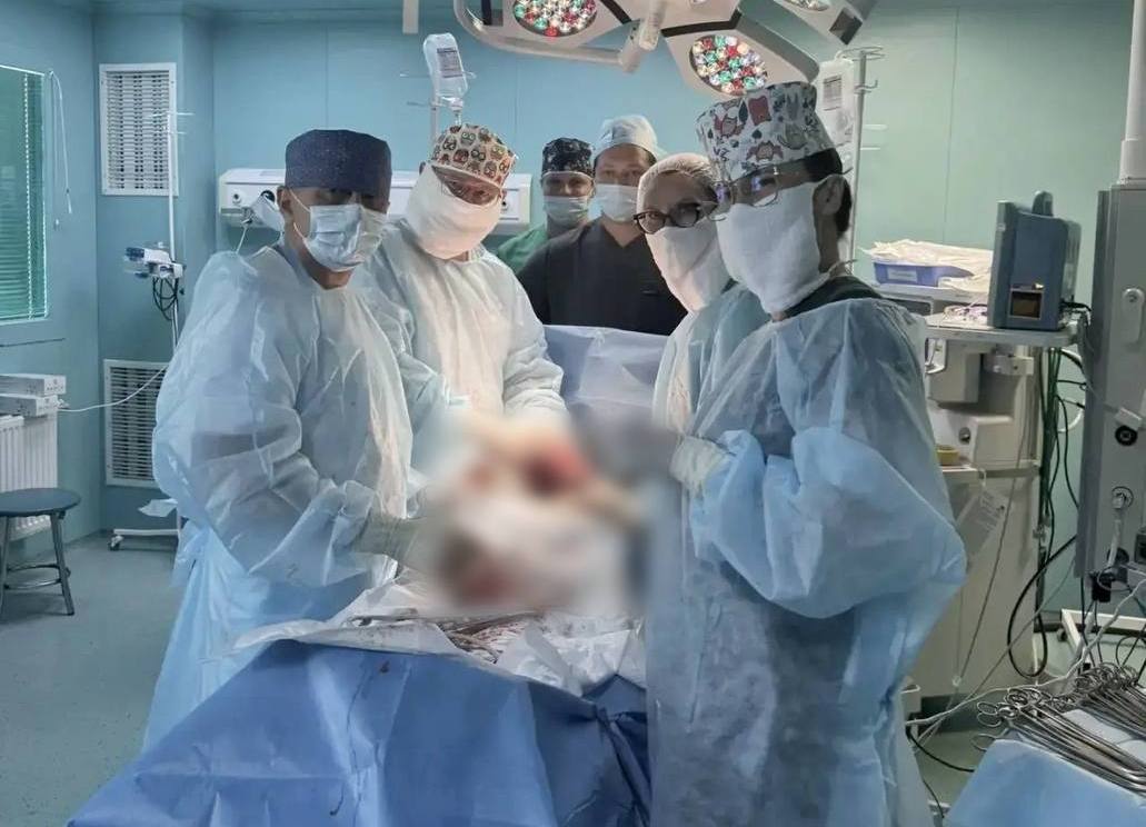 Кесарево сечение и удаление опухоли за один раз: крымские гинекологи провели уникальную операцию