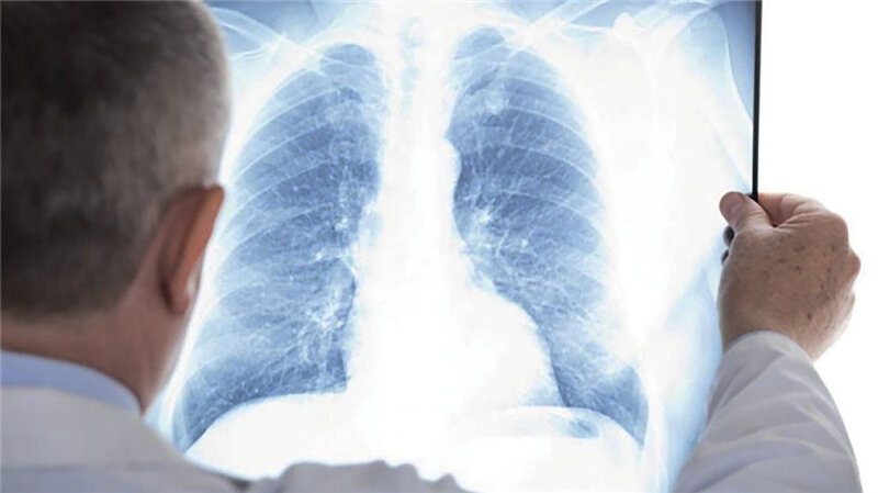 Что нужно знать в ковидное время о заболеваниях лёгких, диагностике, лечении и профилактике
