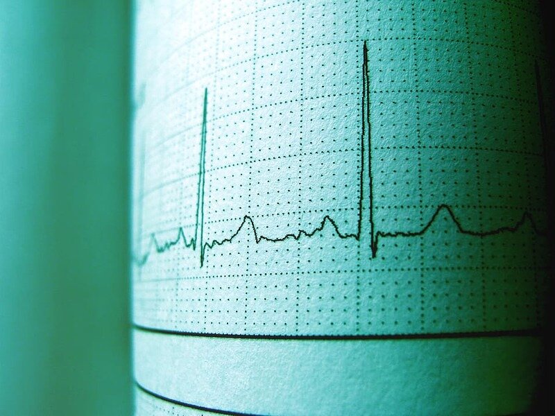 Удар в сердце: как предотвратить инфаркт и инсульт